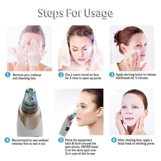 Trendiez 5-in-1 Blackhead Pore Vacuum Remover