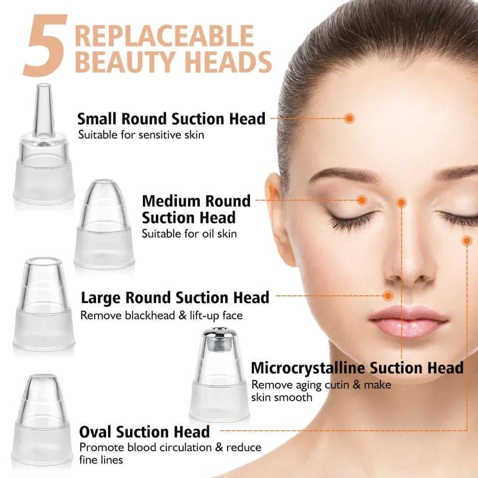 Trendiez 5-in-1 Blackhead Pore Vacuum Remover