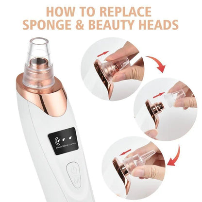 Trendiez 5-in-1 Blackhead Pore Vacuum Remover